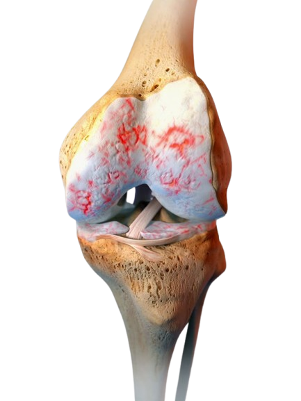 الدروة والأعشاب+ – باقة الشهر